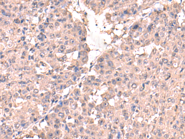 HPN Antibody
