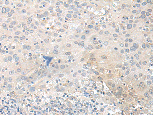 TUBG2 Antibody