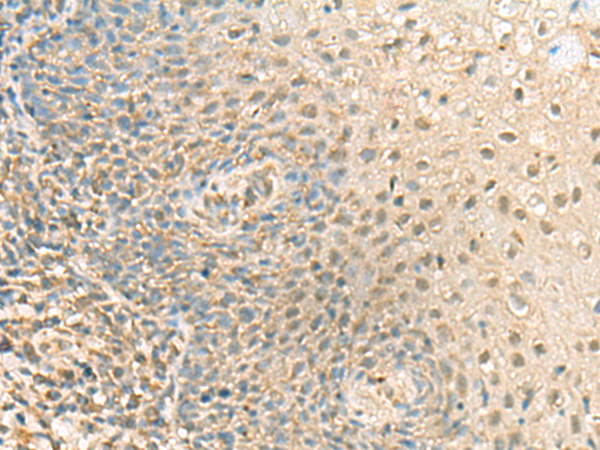 PPCDC Antibody