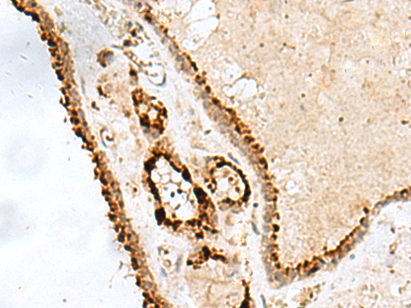 PHTF1 Antibody