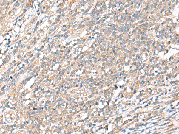 WDR47 Antibody