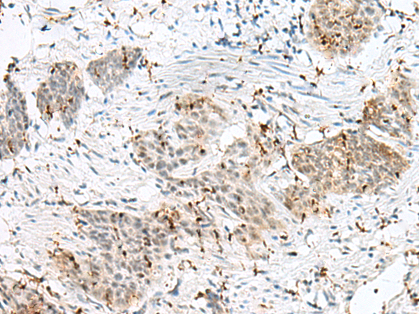 PLCL2 Antibody