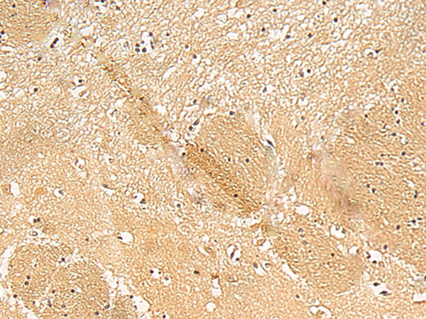 TXNDC12 Antibody