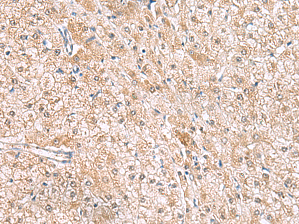HLA-E Antibody