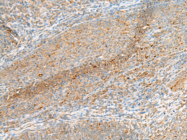IZUMO1R Antibody