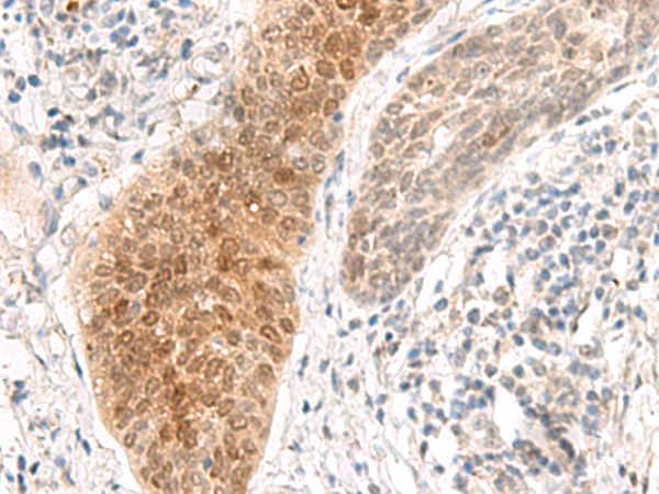 GHDC Antibody