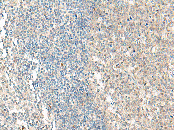 NPBWR1 Antibody