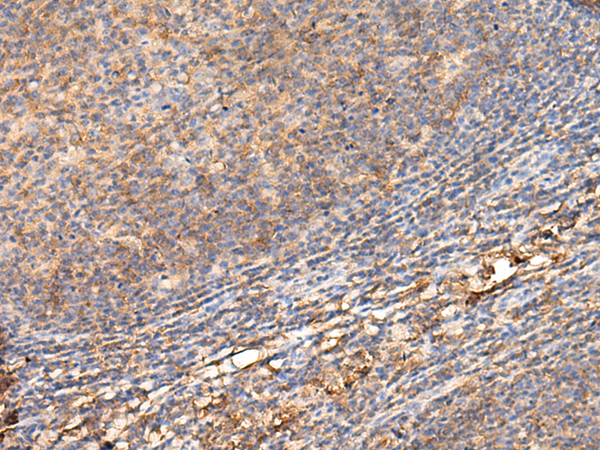 ADGRA1 Antibody