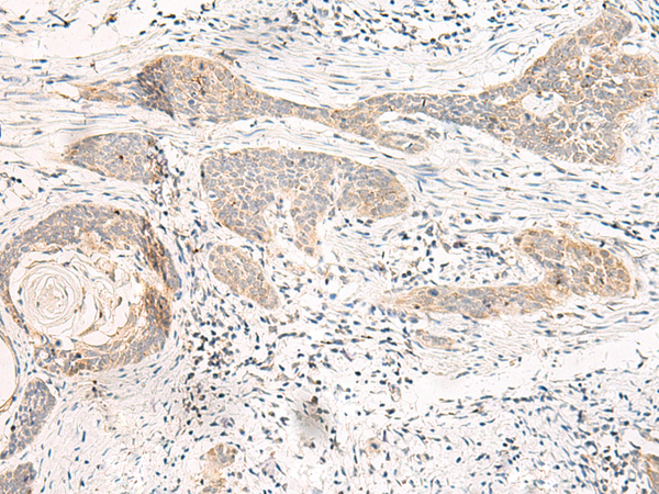GUCY1B2 Antibody