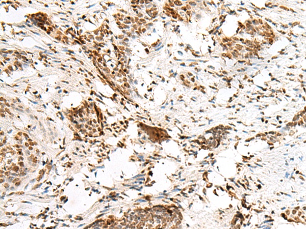 HNRNPCL1 Antibody