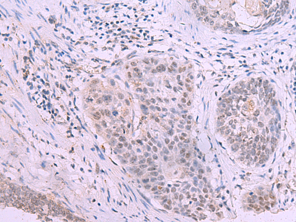 HOXD4 Antibody
