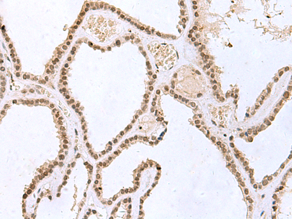 ITGB4 Antibody