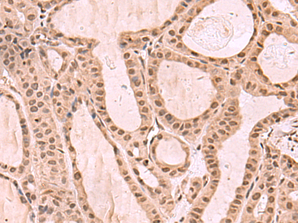 KDM7A Antibody