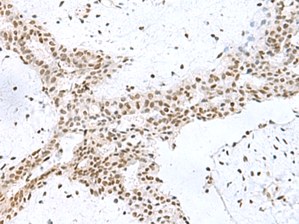 PUM3 Antibody
