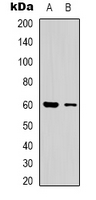 CLIP3 Antibody