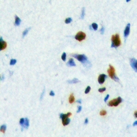 FOXE3 Antibody