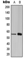 FOXC1/2 Antibody