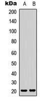 CD306 Antibody