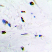 ZNF307 Antibody