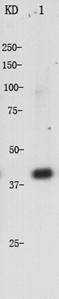 α-Actin (cardiac actin) Antibody