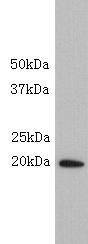 SCA Antibody