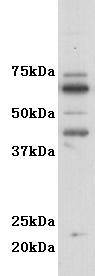GM-CSF-R-alpha (CD116) Antibody