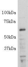 Alkaline Phosphatase(PLAP/PLAP-like) Antibody