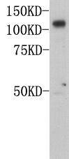 MCAM(CD146) Antibody