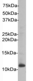 Beta-2 Microglobulin Antibody
