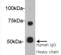 Vitamin K-dependent protein S Antibody