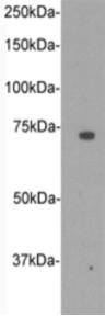 CD105 Antibody
