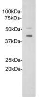 IL1RL1 Antibody