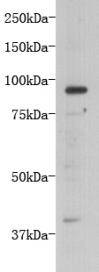TMEM132B Antibody