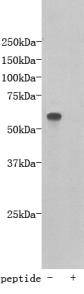 TMEM132E Antibody