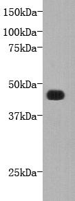 FAT tumor suppressor homolog 4 Antibody