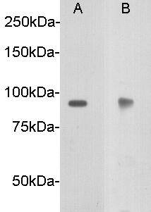 Netrin receptor DCC Antibody