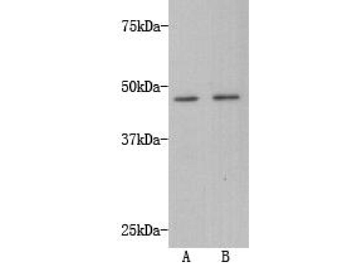 Transmembrane protein 200A Antibody