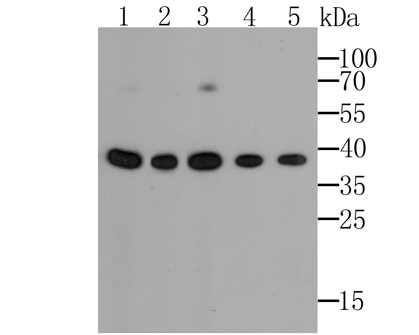 GAPDH Antibody