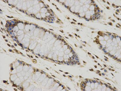CCDC111 Antibody