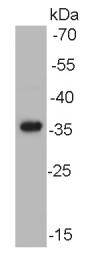 AKR7A2 Antibody