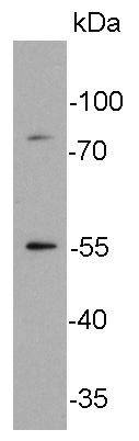 Glucose Transporter GLUT4 Antibody