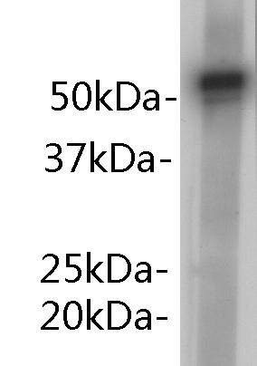 alpha 1-antitrypsin Antibody