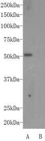 Autoimmune regulator (AIRE) Antibody