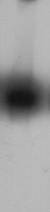 TNF alpha Antibody