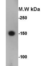 CD56 Antibody