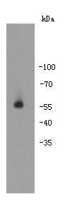 Autoimmune regulator (AIRE) Antibody