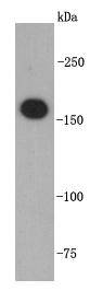 TOP2A Antibody