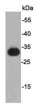KT3 Tag Antibody