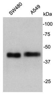 Cathepsin B Antibody