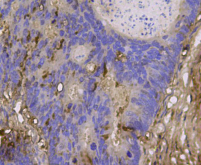 BMP11 Antibody